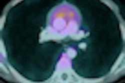 2011 09 23 13 51 23 341 2011 09 26 Pet Ct Thumb