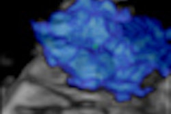 2011 09 26 11 38 29 741 2011 09 27 Breast Us Thumb