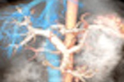 2011 09 28 11 41 09 122 2011 09 29 3 Tmr Aabdomen Thumb