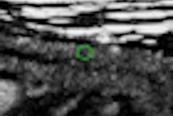 2011 10 03 08 48 14 179 2011 09 30 G Itract Thumb2