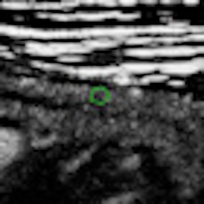 2011 10 03 08 48 14 179 2011 09 30 G Itract Thumb2