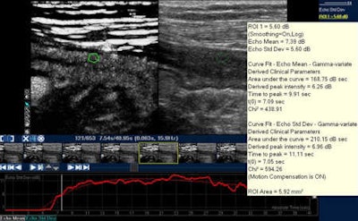 Contrast-enhanced ultrasound of the bowel after sulphur hexafluoride-filled microbubble injection. Analysis of bowel wall perfusion with a quantitative software (intensity curve versus time). Image courtesy of Dr. Carla Serra.