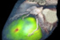2011 09 30 10 31 29 423 2011 10 03 Spect Ct Thumb