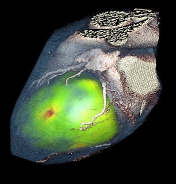 3D reconstruction
