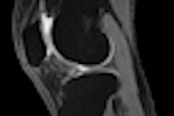 2011 10 04 15 30 42 430 2011 10 05 Obesity Knee Mri Thumb