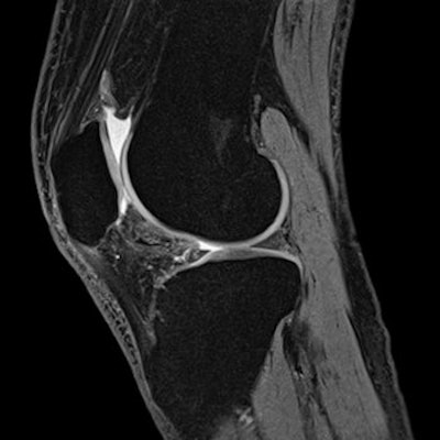 2011 10 04 15 30 43 858 2011 10 05 Obesity Knee Mri