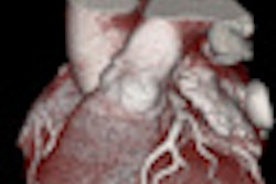 2011 10 06 09 01 23 323 2011 10 06 Chest Pain Thumb
