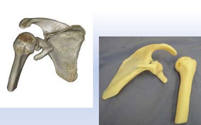 2011 10 11 14 46 40 277 Sosna orthopedic middle