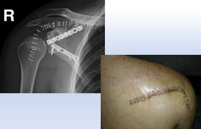 2011 10 11 14 46 41 344 Sosna orthopedic bottom