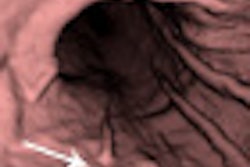 2011 10 12 15 25 20 131 2011 10 13 Ct Gastro2 Thumb