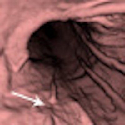 2011 10 12 15 25 20 131 2011 10 13 Ct Gastro2 Thumb