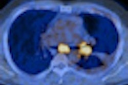 2011 10 14 14 10 18 621 Petct 2 Steinert Lung 70
