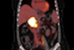 2011 10 19 08 26 23 303 2011 10 19 Eanm2 Thumb