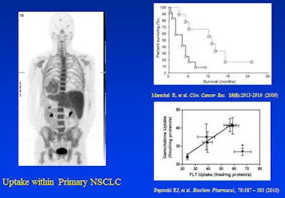The FLT image is of a patient with non-small cell lung cancer (NSCLC) showing marked positive uptake. Marechal has shown that survival following nucleoside-based chemotherapy correlates directly with the expression of human equilibrative transporters. Paproski has shown that gemcitabine and FLT have the same transport into cells in vitro. It is possible to hypothesize that FLT uptake in a patient with NSCLC will be a predictor of response to nucleoside-based chemotherapy.