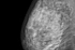 2011 10 25 11 29 37 298 2011 10 26 Uk Breast Thumb