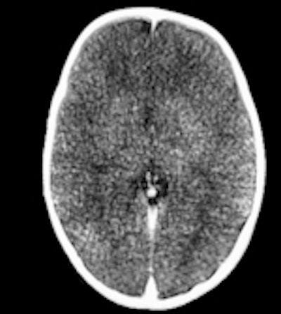 Volume-rendered 3D image