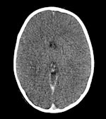 Conventional CT image