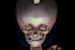 2011 10 26 09 38 22 612 2011 10 16 Autopsy Thumb