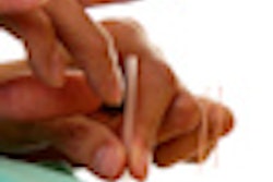 2011 11 02 08 45 10 206 2011 11 02 Acupuncture Thumb