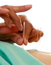 Acupuncture is a branch of traditional Chinese medicine that has been practiced for thousands of years in China and the Far East, but studying its effects has proved difficult.