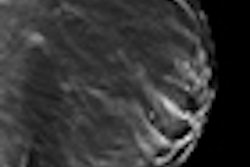2011 11 02 15 17 23 929 2011 11 03 Dbt Thumb