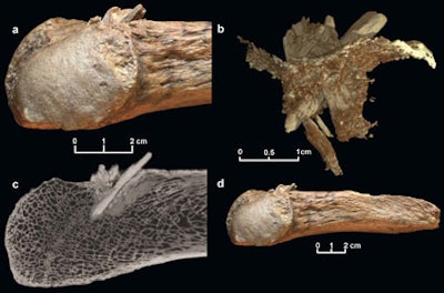This figure shows a mastodon rib with the embedded bone projectile point. A: Close-up view. B: Reconstruction showing the bone point with the broken tip. The thin layer represents the exterior of the rib. C: CT image showing the long shaft of the point from the exterior to the interior of the rib. D: The entire rib fragment with the embedded bone projectile point.