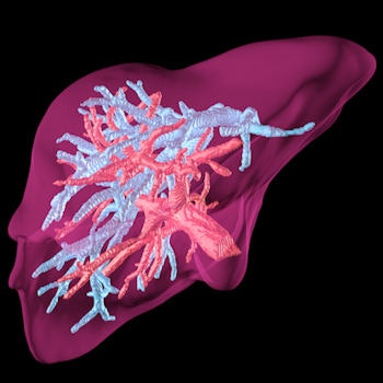 Holoxica's 3D hologram of the liver.