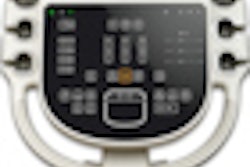 2011 11 14 17 31 12 833 2011 11 15 Philips Sparq Thumb