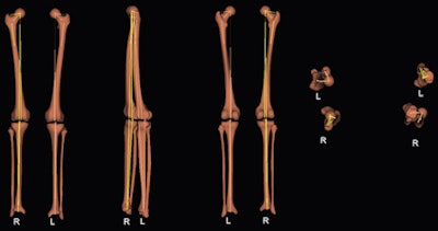 From left to right, 3D reconstructions views: frontal, lateral, back, up, and down