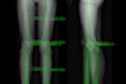 2011 11 15 12 45 58 546 2011 11 15 Eos Thumb
