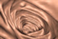 2011 11 21 10 53 44 329 2011 11 22 Virtual Colonoscopy