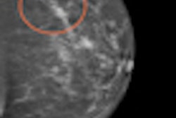 2011 11 22 12 18 20 186 2011 11 22 Thumb