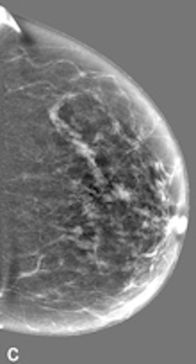 Resulting image of subtracting TE from PV