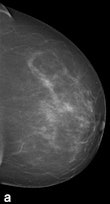 Tissue equalization (TE) processed image