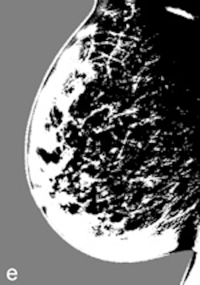 Thresholded version of D