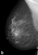 Tissue equalization (TE) processed image