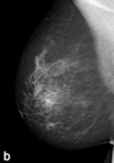 Tissue equalization (TE) processed image