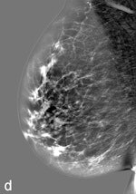 The resulting image of subtracting TE from PV