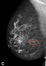 Premium view (PV) processed image with the annotation