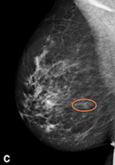 Premium view (PV) processed image with the annotation