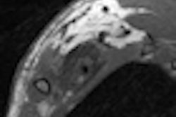 2011 11 23 10 52 49 261 2011 11 23 Mri Brachial Thumb