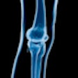 2011 11 29 11 17 03 976 Knee Xray 70