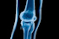 2011 11 29 11 17 03 976 Knee Xray 70