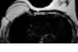 2012 04 10 14 44 04 909 Thumb