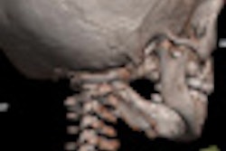 2011 12 06 15 26 10 319 2011 12 07 Autopsy Thumb