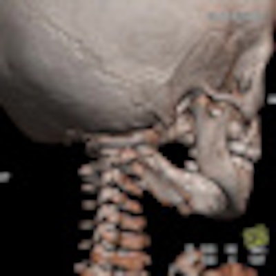 2011 12 06 15 26 10 319 2011 12 07 Autopsy Thumb