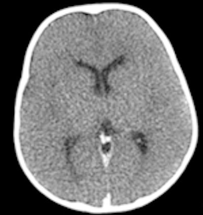 Conventional CT
