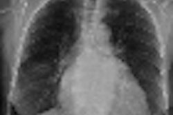 2011 12 13 12 34 42 255 2011 11 29 Digital Tomo Xray Thumb