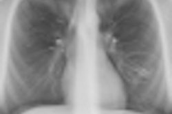 2011 12 16 10 59 37 961 2011 12 19 Fibrosis Thumb