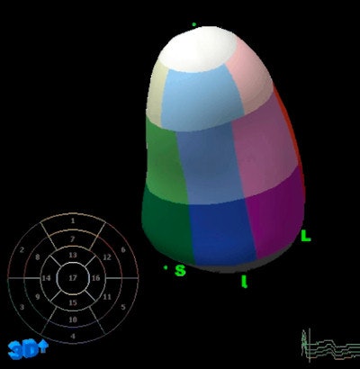 Diastole in 3D